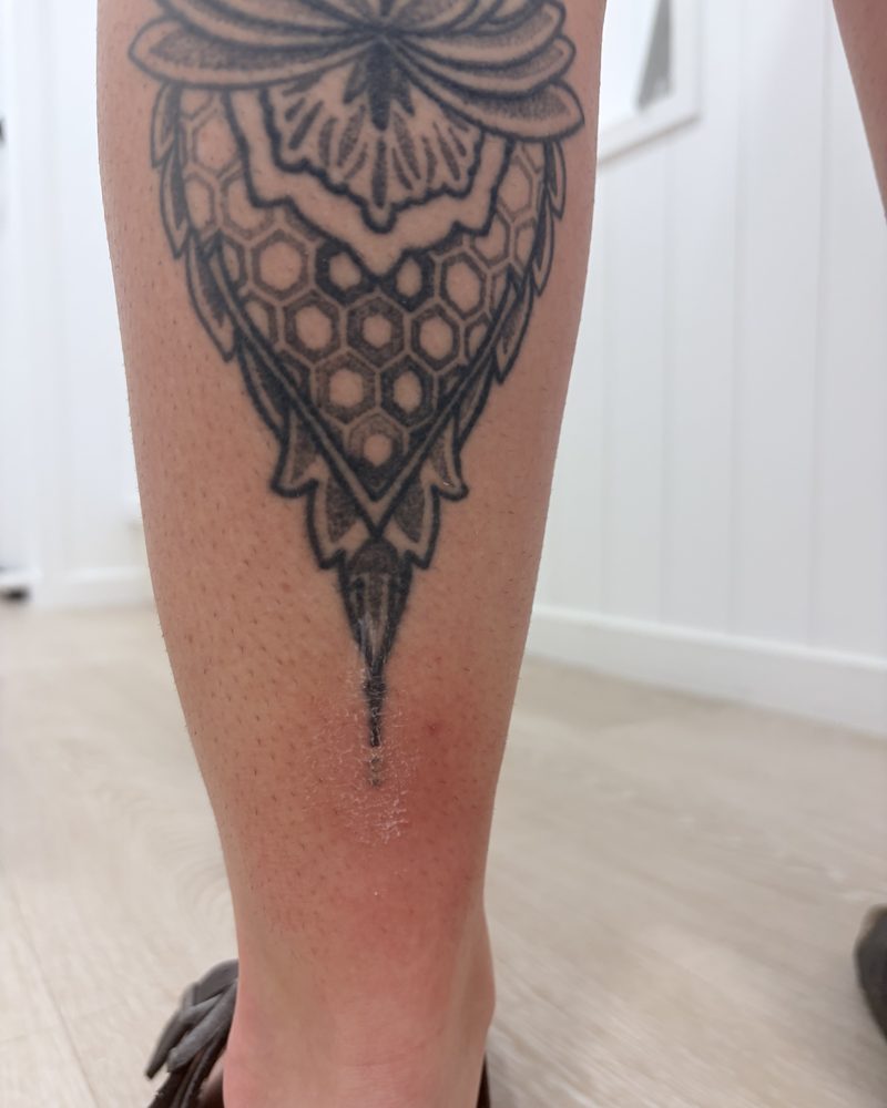 Bold blackwork mandala tattoo on a lower leg before treatment