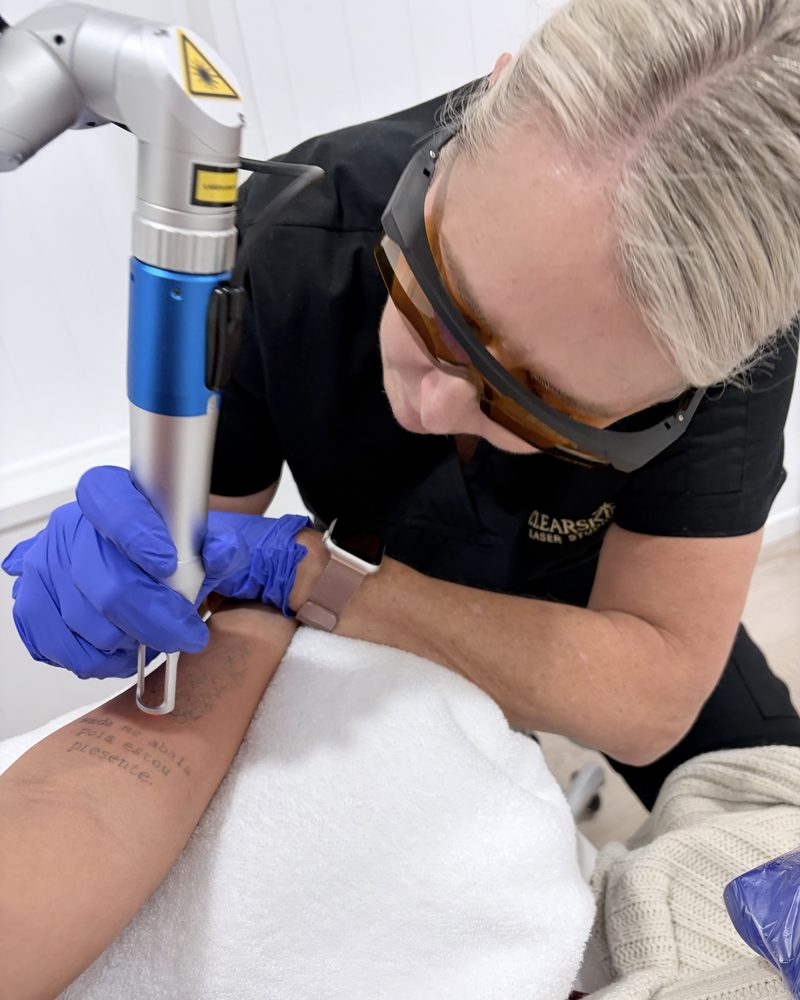 Sandi treating a forearm tattoo with the laser handpiece