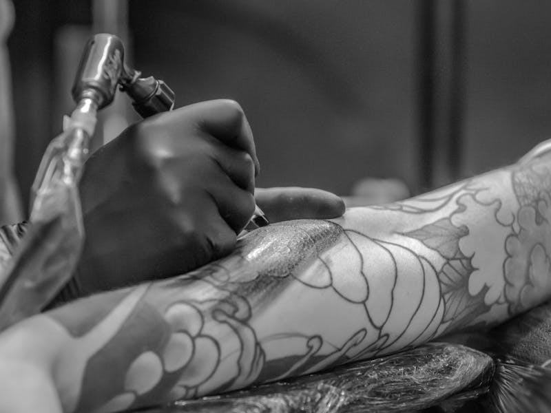Laser tattoo removal close-up